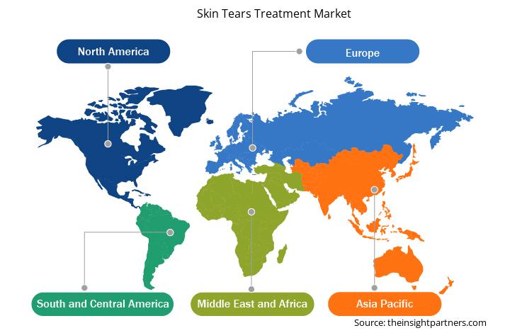 skin-tears-treatment-market-global-geography