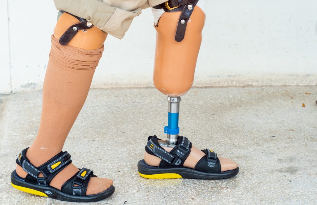 Gait Rehabilitation System Market Shares overview with CAGR of 5.8% ...